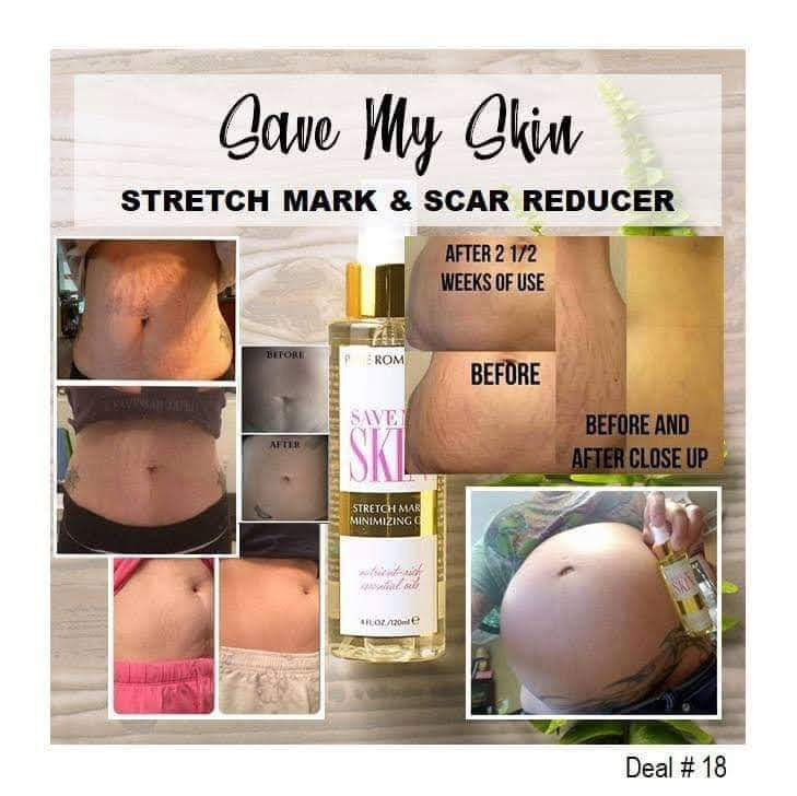 HeLi - Stretch Mark Minimizing Oil